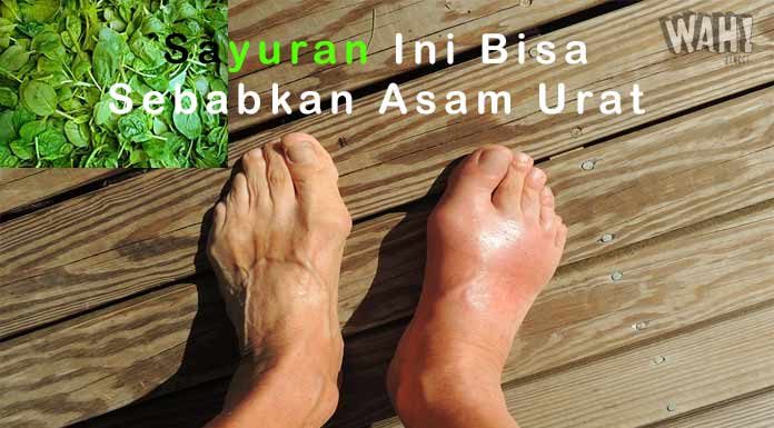 Sayuran Ini Bisa Sebabkan Penyakit Asam Urat