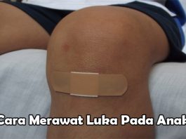 Cara Merawat Luka Gores Pada Anak Dengan Baik Wahbanget