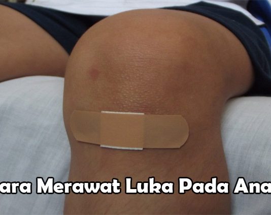 Cara Merawat Luka Gores Pada Anak Dengan Baik Wahbanget