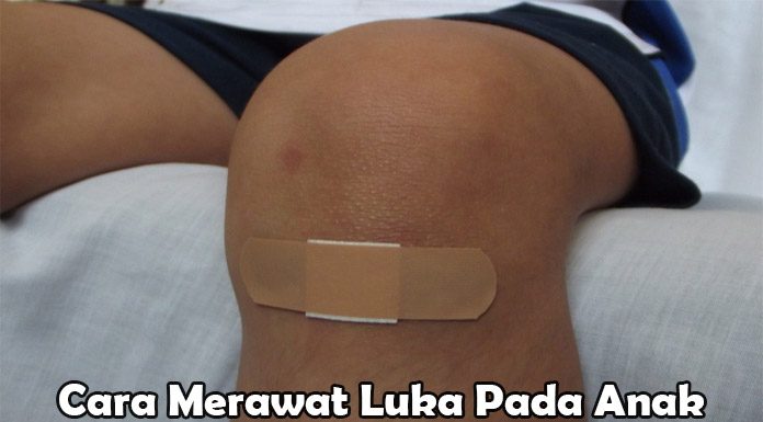 Cara Merawat Luka Gores Pada Anak Dengan Baik Wahbanget