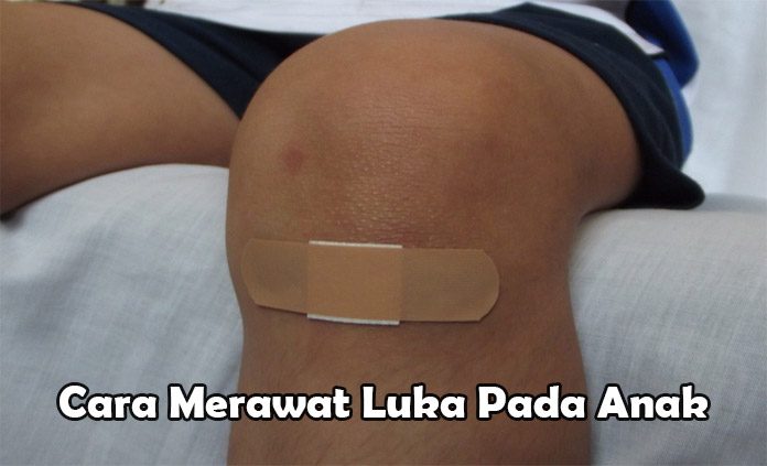 Cara Merawat Luka Gores Pada Anak Dengan Baik Wahbanget